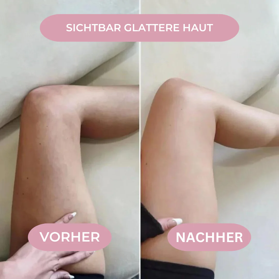 Slimora Anti Cellulite
